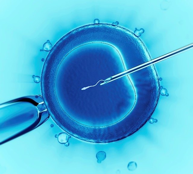 This image shows Intracytoplasmic Sperm Injection, the most commonly used IVF technique. https://commons.wikimedia.org/wiki/File:InVitroFertilization.jpg